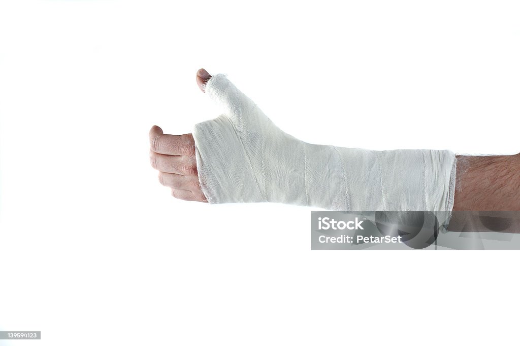 Рука в Штукатурка чугуна - Стоковые фото Сломанная рука роялти-фри