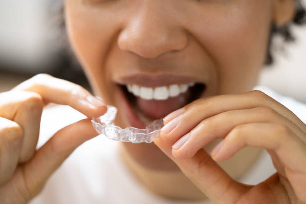 istock Clear Aligner Dental Night Guard 1396022040