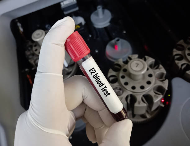 科学者は、e2(エストラジオール)血液検査のための血液サンプルを保持しています。 - follicle stimulating hormone ストックフォトと画像
