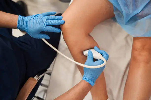 Cropped view of the male doctor wearing protective gloves holding special device while making ultrasound therapy for woman. Ultrasound of the veins of the lower extremities concept