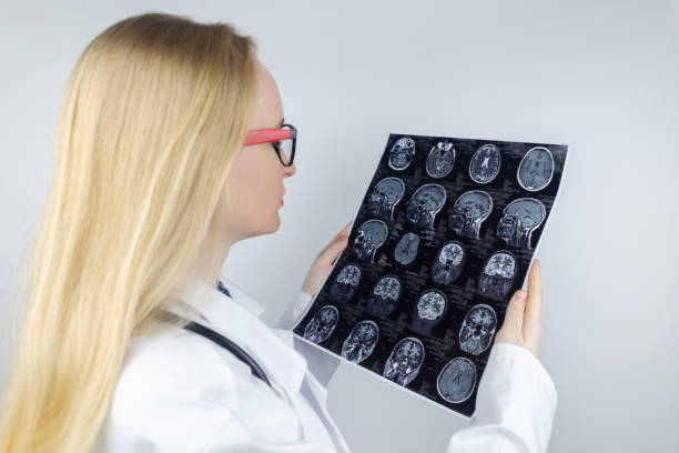 mri mózgu. neuropatolog trzyma obraz na tle urządzenia świetlnego, aby zobaczyć patologie i urazy mózgu. diagnostyka i leczenie nerwobólów, padaczki i innych patologii - neuropathologist zdjęcia i obrazy z banku zdjęć