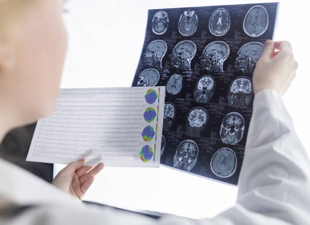 epileptolog bada mri pacjenta i elektroencefalogram. koncepcja leczenia padaczki i pomocy osobom cierpiącym na tę chorobę. neurolog w pracy. patologia mózgu. aktywność napadowa - neuropathologist zdjęcia i obrazy z banku zdjęć