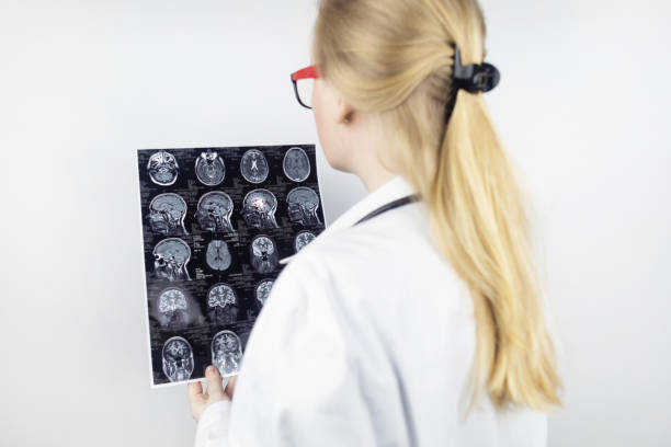 Epileptologist examines patient MRI and electroencephalogram. Concept treating epilepsy and helping people who suffer from this disease. Neurologist at work. Pathology of the brain. Seizure activity stock photo