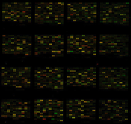 DNA microarrays are used in biological research to simultaneously measure the expression of thousand of genes.