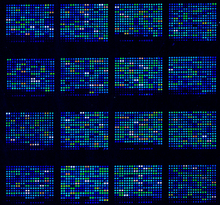 DNA microarrays are used in biological research to simultaneously measure the expression of thousand of genes