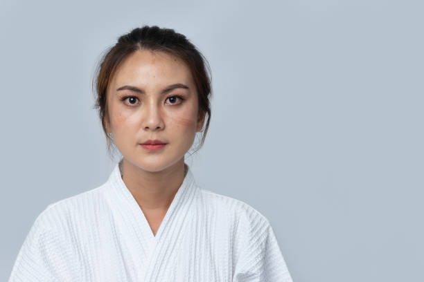 화이트 와플의 아름다운 아시아 여성의 초상화는 어두운 반점, 얼굴 흉터, 얼굴에 죽은 피부 세포가있는 목욕 가운을 짜냅니다. 의료 종사자를위한 코로나 바이러스 보호 장비 n95 마스크의 효과 - 기미 뉴스 사진 이미지