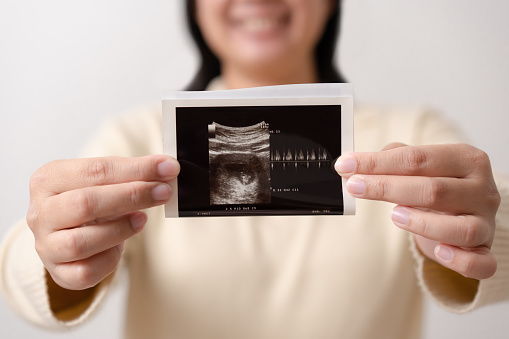 Pregnant woman holding ultrasound scan of her baby. Happy mother and newborn baby in process. Love of parents to infant through sonogram in few months before give birth.