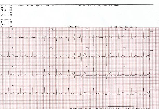 ECG full strip stock photo