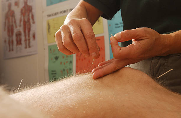 acupuncture stock photo