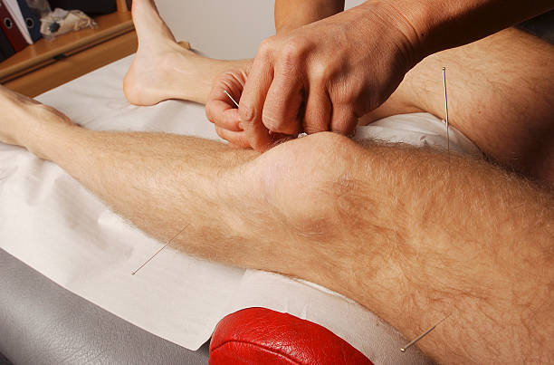 acupuncture 1 Man getting acupuncture at a clinic human knee stock pictures, royalty-free photos & images