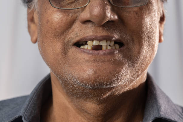 Dental problem Close up of missing teeth of an old Indian male gap toothed stock pictures, royalty-free photos & images