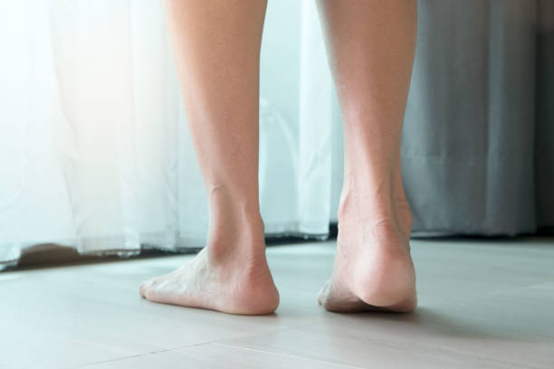 그가 건강과 이완 개념을 운동하기 위해 걷고있는 여성의 다리.부드러운 초점 - reflexology beauty naked human foot 뉴스 사진 이미지