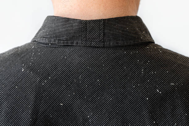 비듬으로 덮인 검은 셔츠에 사람의 어깨를 가까이서 볼 수 있습니다. 공간을 복사합니다. 건선과 지루성 피부염의 개념 - dander 뉴스 사진 이미지