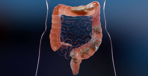 3d illustration of human digestive system anatomy, concept of the intestine, laxative, traitement of constipation, 3d render stock photo