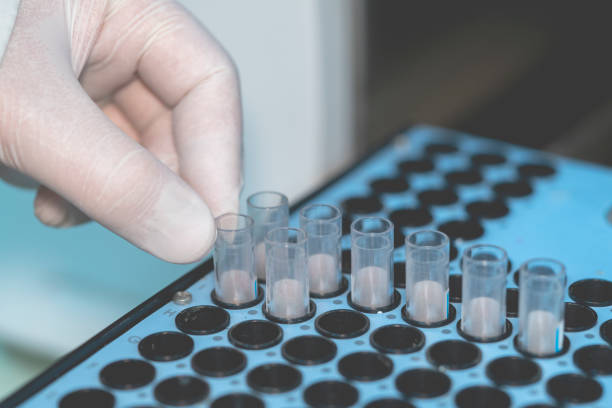 istock Blood examination stock photo 1396911388