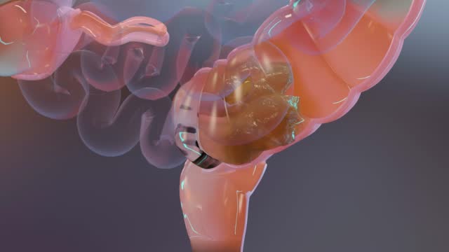 Anatomy of the human digestive system, concept of the intestine,  laxative, treatment of constipation, 3d render