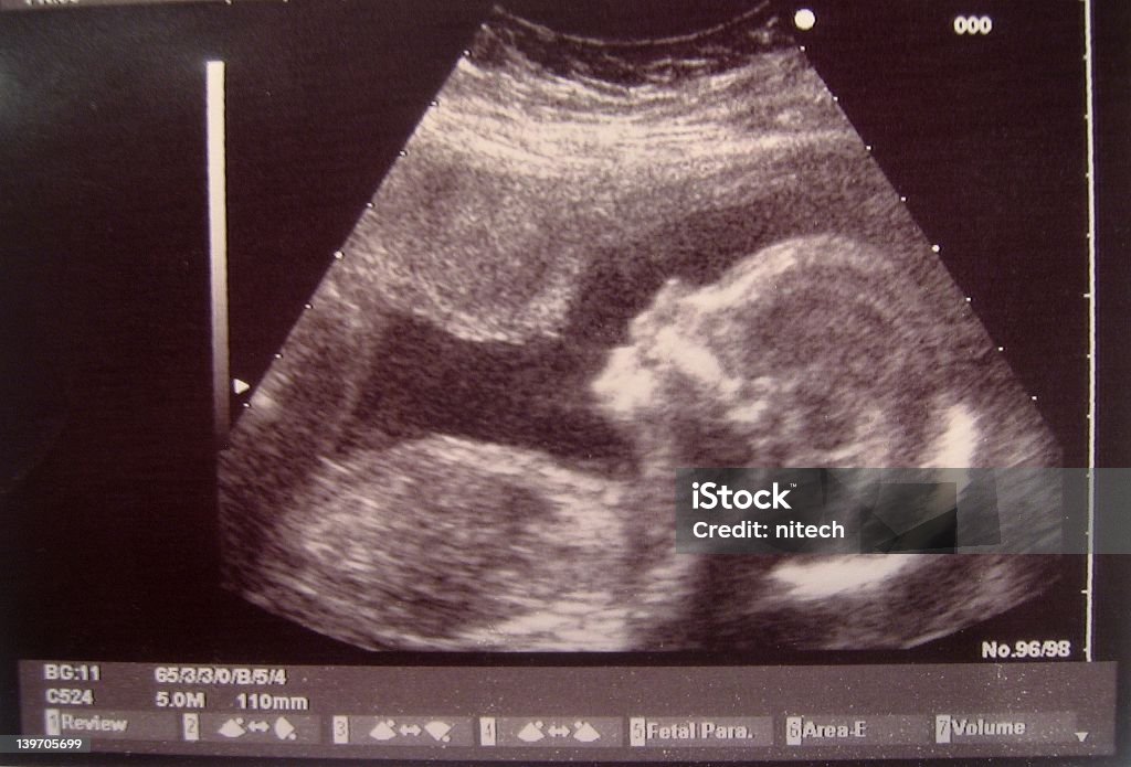 Ultrasonic baby An infant smiling inside her mother's belly. Fetus Stock Photo