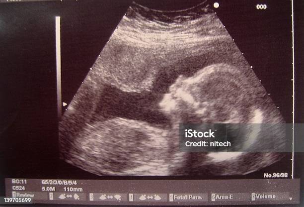 Ultrasonic Baby Stock Photo - Download Image Now - Fetus, Ultrasound, Photography