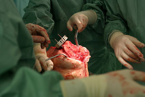 chirurgo al lavoro-l'impianto di un ginocchio 2 sapeva - human vein animal knee human artery human cardiovascular system foto e immagini stock