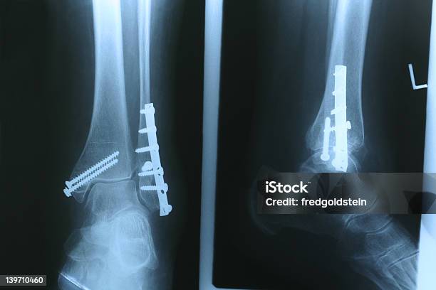 Xray01 — стоковые фотографии и другие картинки Буква X - Буква X, Винт, Горизонтальный