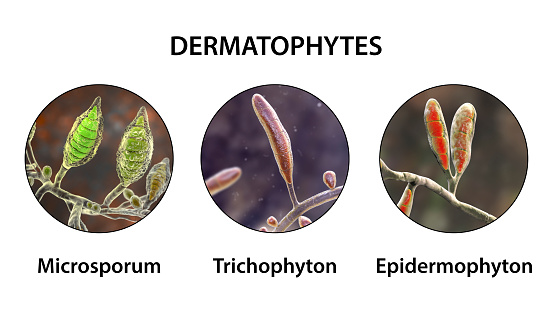 Dermatophyte fungi, 3D illustration. Microsporum, Trichophyton, and Epidermophyton, the causative agents of ringworm, tinea, skin, hair and nail disease