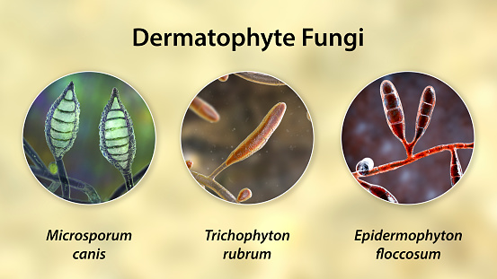 Dermatophyte fungi, 3D illustration. Microsporum, Trichophyton, and Epidermophyton, the causative agents of ringworm, tinea, skin, hair and nail disease