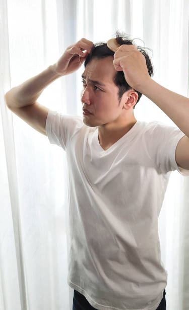 homme inquiet de la perte de cheveux - east asian ethnicity photos et images de collection