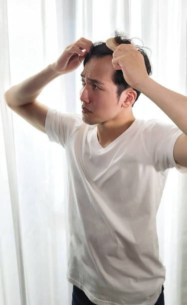 uomo preoccupato per la caduta dei capelli - east asian ethnicity foto e immagini stock