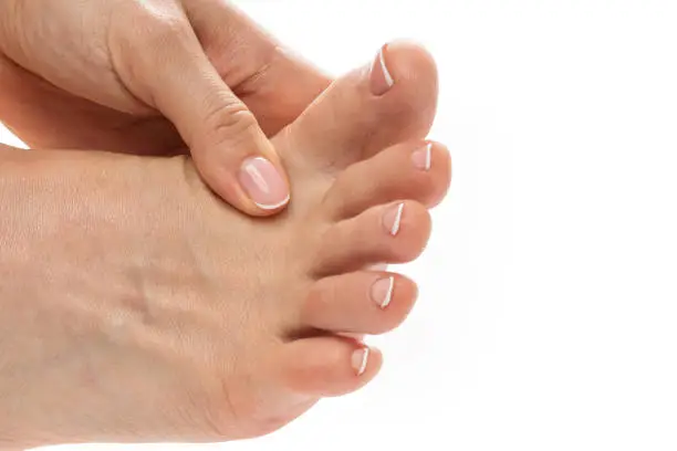 Photo of Female feet with itchy skin affected by fungal infection