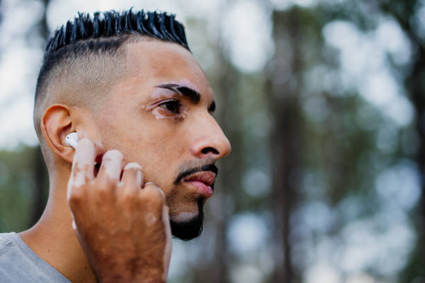 istock Portrait of a man with vitiligo 1397273467