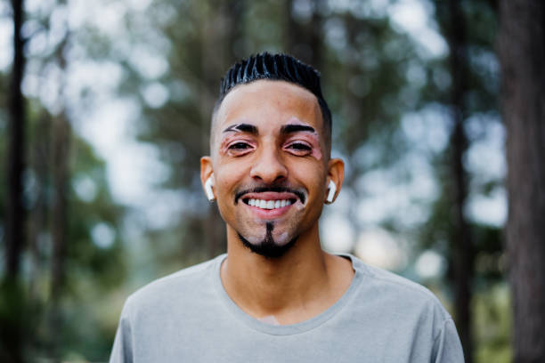 portrait d’un homme atteint de vitiligo - men smiling headphones individuality photos et images de collection