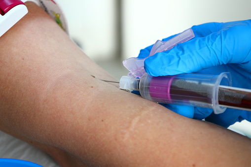 A female patient having blood drawn for testing by a laboratory.