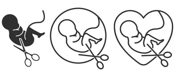Vector illustration of Embryo with scissors. Abortion sign. Stop Abortion Campaign. Vector illustration.
