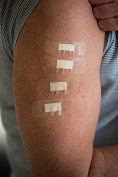 istock A man's arm with four bandaids 1397436054
