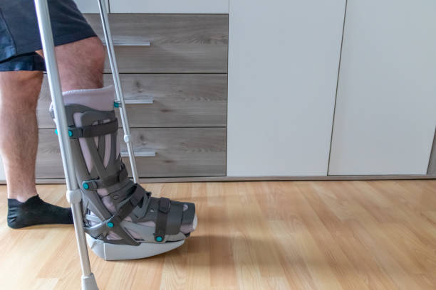 european man after achilles tendon rupture operation is back home with moon boot special physiotherapy shoe and crutches for recovery at home against the hurting leg learning to walk first steps pwb - moonboots imagens e fotografias de stock
