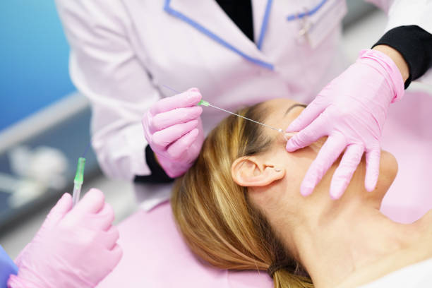 Doctor injecting PDO suture treatment threads into the face of a woman. Doctor injecting PDO suture treatment threads into the face of a middle-aged woman. filament stock pictures, royalty-free photos & images