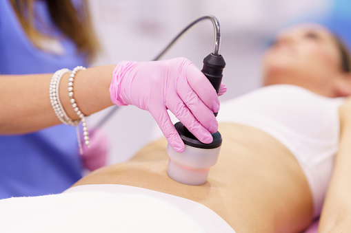 Middle-aged woman receiving anti-cellulite treatment with radiofrequency machine in a beauty center.