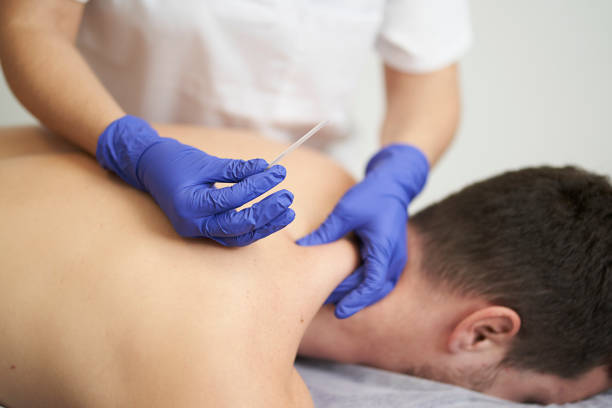 istock physiotherapist treating an overload with dry needling 1397565680