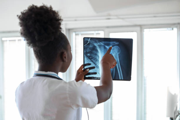 엑스레이 필름 헬스케어, 로엔겐, 사람 및 의학 개념을 보고 있는 병원에서 여성 의사. 의사의 사무실에서 x 선을 가리키는 청진기를 가진 젊은 웃는 여성 의사 - human spine mri scan x ray doctor 뉴스 사진 이미지