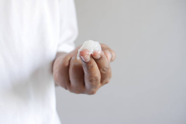 istock Close up of man hand using petroleum jelly 1397752385