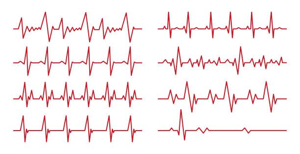 istock Set of 8 pcs. heart pulse - curved red line on white background - Vector 1397833813