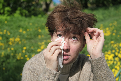 Woman is sneezing, blowing nose and drying tears outdoors while having pollen allergy in springtime