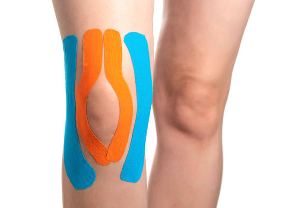 articulación de la rodilla fijada con cinta kinesiológica azul y naranja, primer plano. pegado de músculos y ligamentos en los deportes, primer plano - kinesio fotografías e imágenes de stock