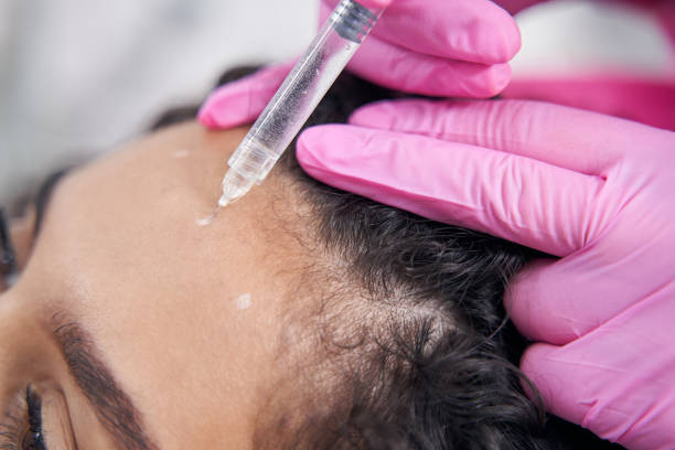 istock Syringe is injected subcutaneously on the forehead along pre-drawn contours 1397984372