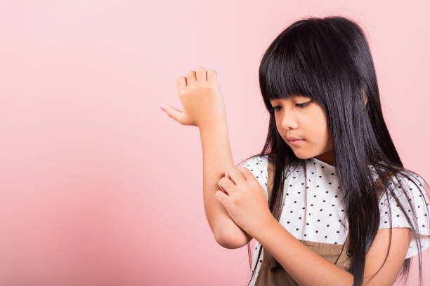 istock Asian little kid 10 years old scratching itch arm from a mosquito bite 1398021507