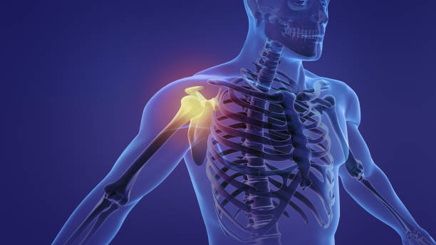 istock Animation of a painful shoulder 1398089914