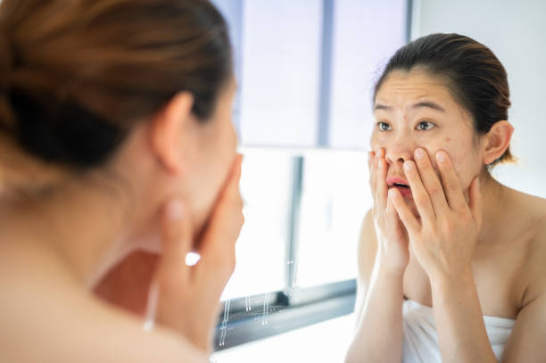 istock Asian woman feeling stress after looking her face in mirror. 1398113577
