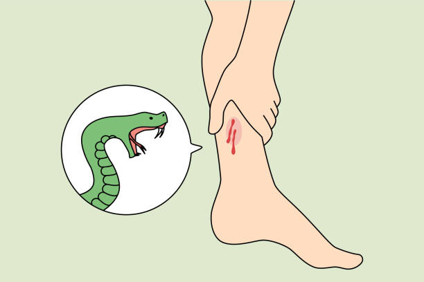 Snake bite person leg Close up of snake bite person leg need emergency medical help. Poisonous serpent snap outdoors. First aid and healthcare concept. Flat vector illustration. reptile feet stock illustrations
