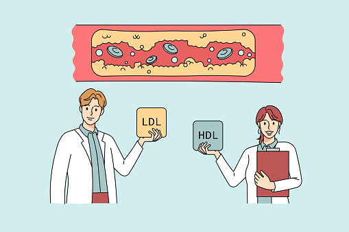 Diverse doctors demonstrate cholesterol in human body vessels. Therapists show high ldl and hdl levels in blocked vascular. Plaque disease and fat cells concept. Flat vector illustration.