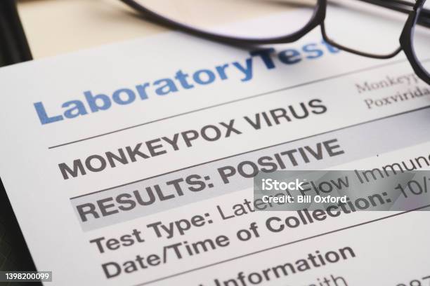 Monkeypox Virus Test Results Document Stock Photo - Download Image Now - Mpox, Scientific Experiment, Virus